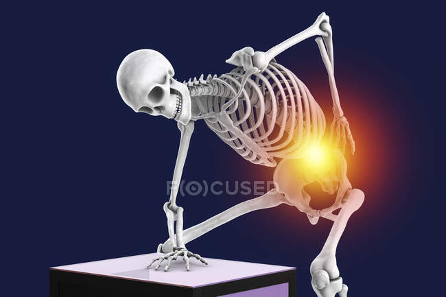 Dolor de espalda. Ilustración conceptual por computadora de un esqueleto humano sosteniendo una mano en la parte baja de la espalda. El dolor lumbar, llamado lumbago, es muy común, y es causado por daño a los músculos y tendones que rodean la columna vertebral. - foto de stock