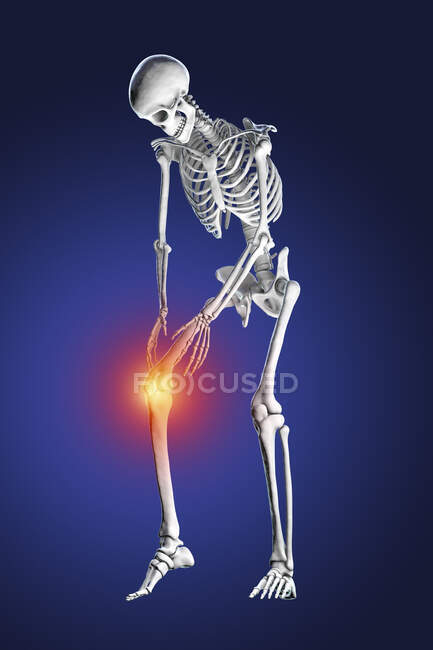 Dolor de rodilla humano, ilustración por computadora. - foto de stock