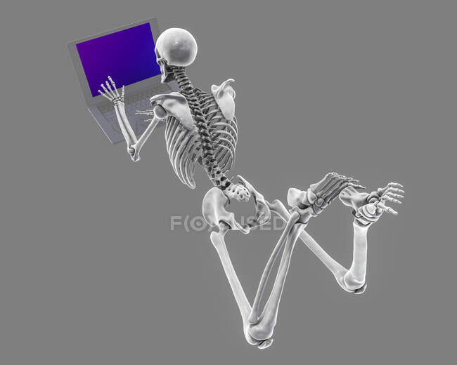 Computerillustration zeigt ein menschliches Skelett mit schlechter Haltung während der Arbeit an einem Laptop. — Stockfoto