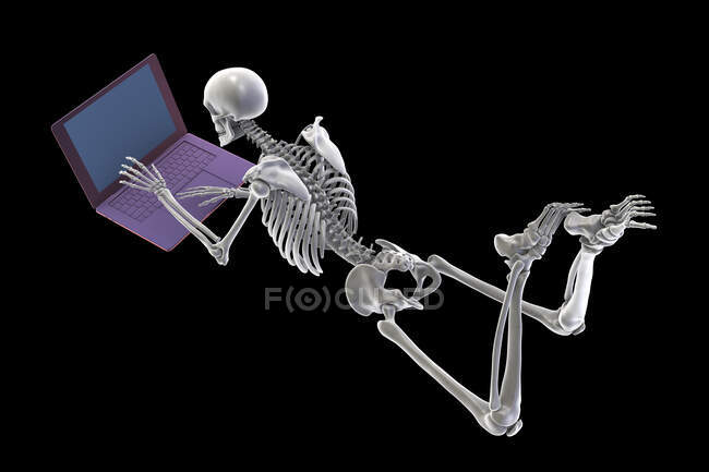 Ilustración por computadora que muestra un esqueleto humano con mala postura mientras trabaja en una computadora portátil. - foto de stock