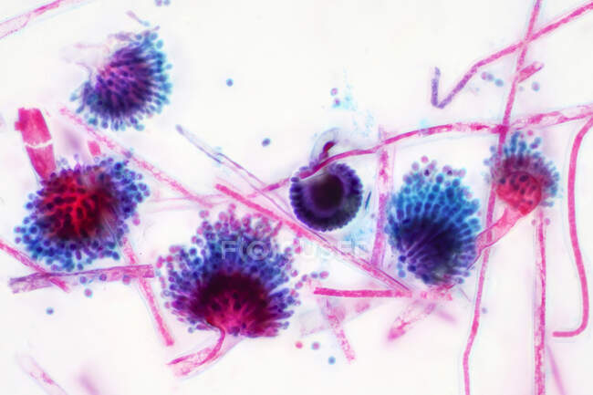 Micrographie photonique d'Aspergillus sp. Champignon. — Photo de stock