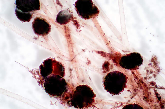 Micrografo leggero di Aspergillus sp. Fungo. — Foto stock