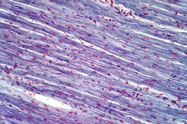 Músculo cardíaco humano, micrografía ligera. Tinción de hematoxilina y eosina. - foto de stock