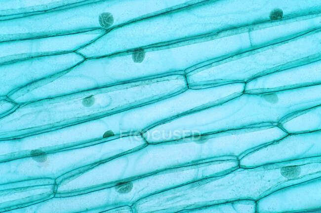 Световая микрография клеток растений. Клетки растений имеют клеточные стенки, построенные вне клеточной мембраны и состоящие из целлюлозы, гемицеллюлозы и пектина.. — стоковое фото