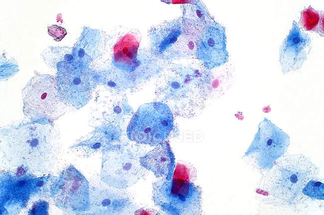 Leichte Mikrographie einer bukkalen Schleimhautzelle. Diese Zelle säumt die Wangen und den Rücken der Lippen. — Stockfoto