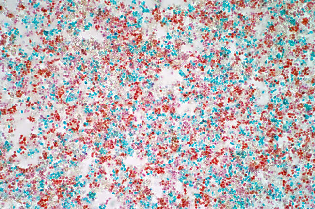 Micrographie photonique des cellules bourgeonnantes de levure de bière (Saccharomyces cerevisiae). Saccharomyces cerevisiae est capable de fermenter le sucre, produisant ainsi de l'alcool et du dioxyde de carbone. Il a longtemps été utilisé dans le brassage de la bière, la production de win — Photo de stock