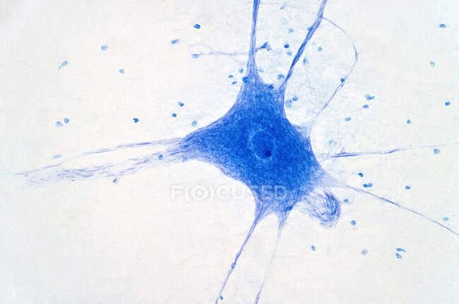 Micrographie lumineuse des cellules nerveuses. — Photo de stock