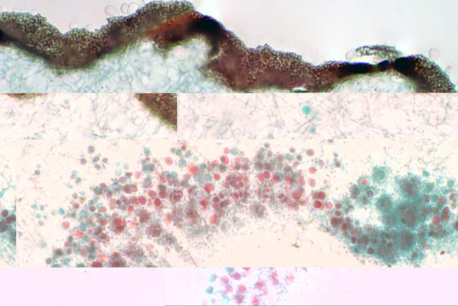 Micrografia de luz mostrando seção transversal de líquen e fungos. — Fotografia de Stock