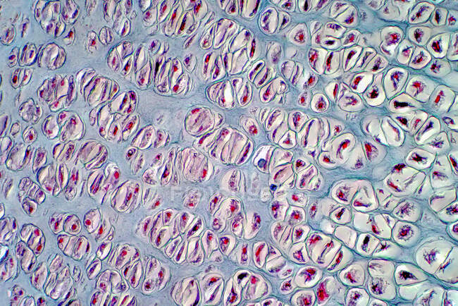Cartilage humain, micrographie lumineuse. Coupe transversale de l'os du cartilage humain. Tache d'hématoxyline et d'éosine. — Photo de stock