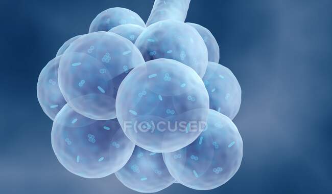 Bacterial lung infection, illustration. — Stock Photo