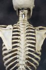 Esqueleto humano de volta no fundo preto — Fotografia de Stock