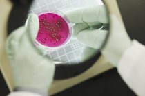 Крупним планом вид вченого, що аналізує бактеріальні колонії — стокове фото