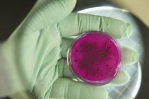 Vista de primer plano del científico que analiza las colonias bacterianas - foto de stock