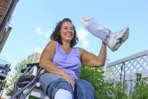 Frau mit Spina bifida zeigt neue Beinspange — Stockfoto