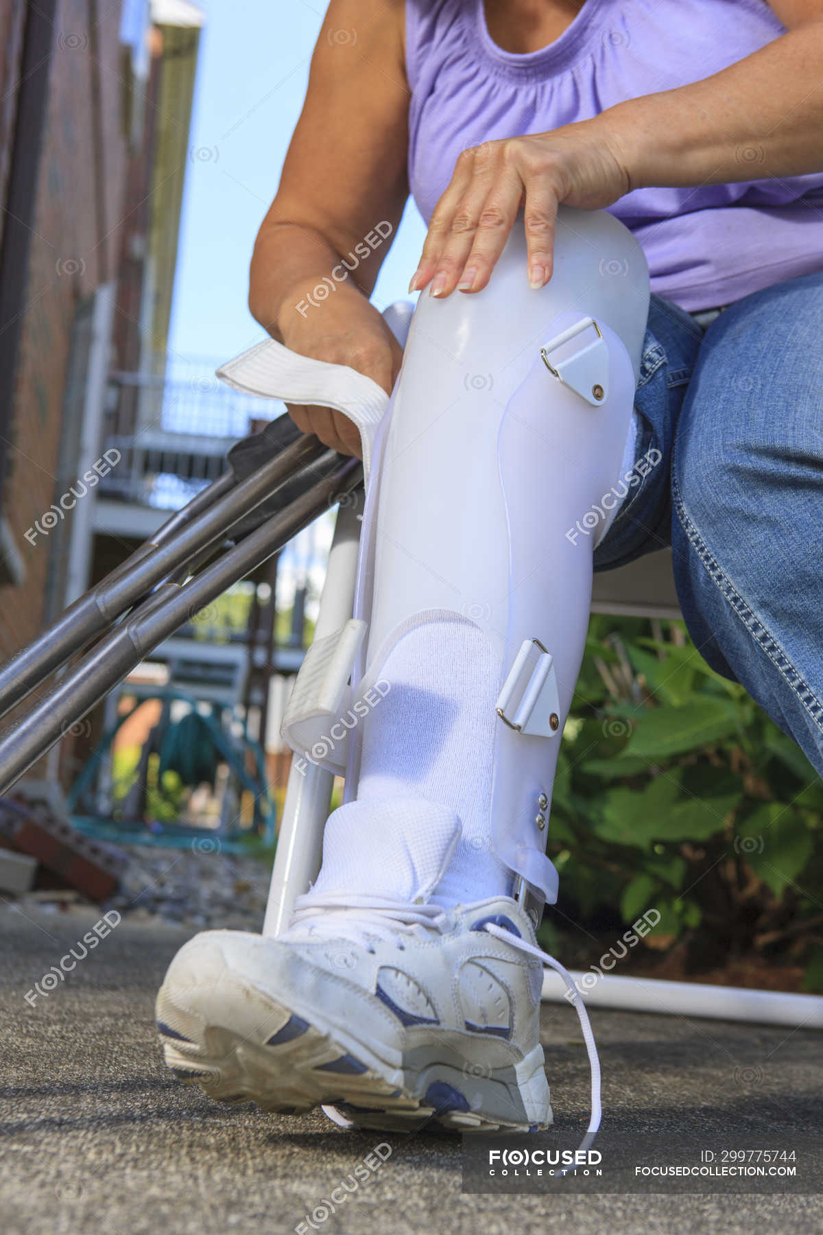 Woman with Spina Bifida adjusting leg brace — myelomeningocele, spinal