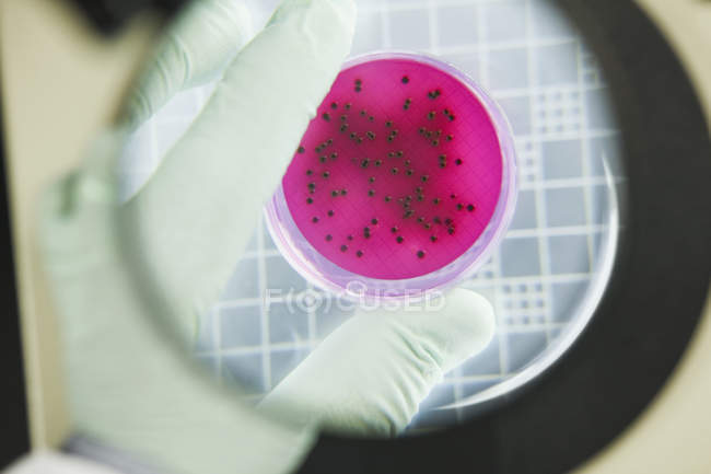 Vue rapprochée du scientifique analysant les colonies bactériennes — Photo de stock