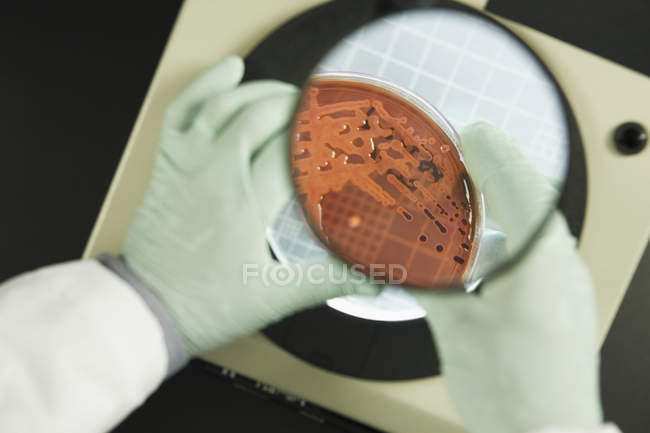 Closeup view of scientist analyzing bacterial colonies — Stock Photo