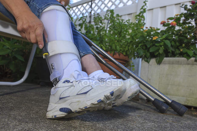 Femme avec Spina Bifida ajustant attelle de jambe — Photo de stock