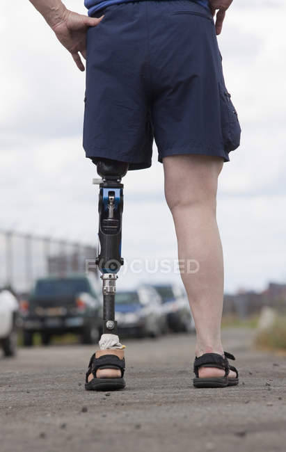 Woman with prosthetic leg standing on the road — Stock Photo