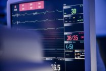 Monitor de pacientes con gráficos y mediciones - foto de stock
