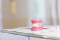 Modelo de dientes con aparatos ortopédicos en cirugía dental - foto de stock