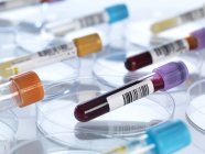 Sang humain et autres échantillons médicaux dans des boîtes de Pétri — Photo de stock