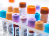 Una fila de muestras de sangre humana a la espera de pruebas en el laboratorio - foto de stock
