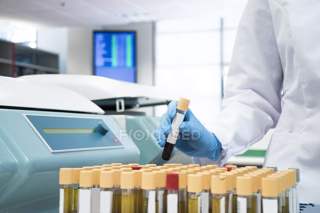Laborant im Analyselabor mit Reagenzglasschale — Stockfoto