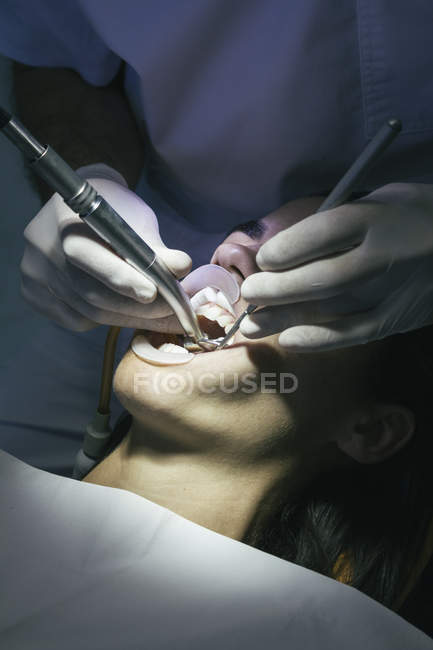 Закри стоматолог робить стоматологічної чищення — стокове фото