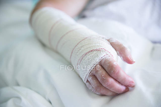 Mulher no hospital, mão operada — Fotografia de Stock