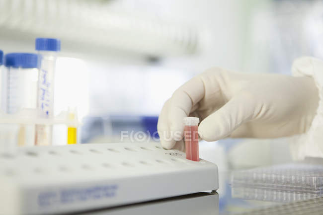 Científico investigando sangre en laboratorio - foto de stock