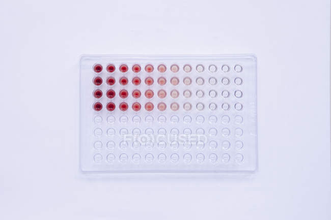 Análisis con sangre en el laboratorio - foto de stock