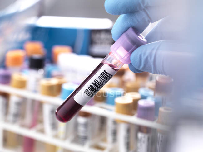 Медицинский техник готовит образец человеческой крови для клинического тестирования — стоковое фото