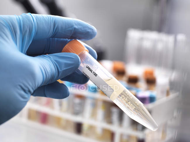 Técnico médico preparando uma amostra de urina humana para testes clínicos — Fotografia de Stock