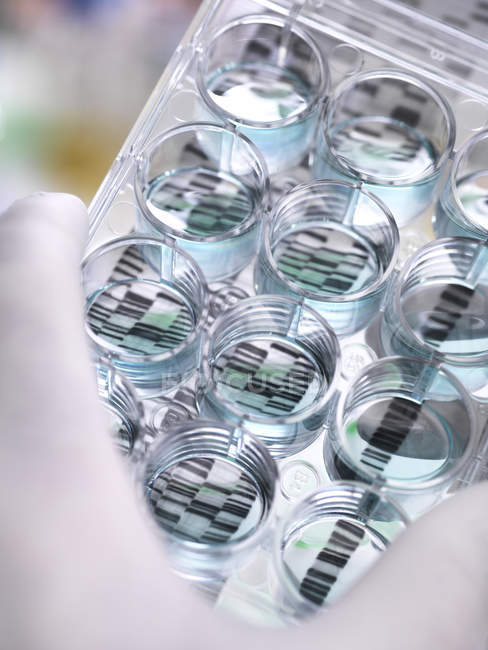 Investigación Genética, Científico sosteniendo una placa de múltiples pozos y gel de ADN revelando, la composición genética de los especímenes - foto de stock