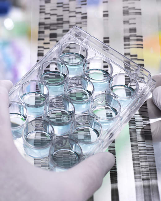 Investigación Genética, Científico sosteniendo una placa de múltiples pozos y gel de ADN revelando, la composición genética de los especímenes - foto de stock