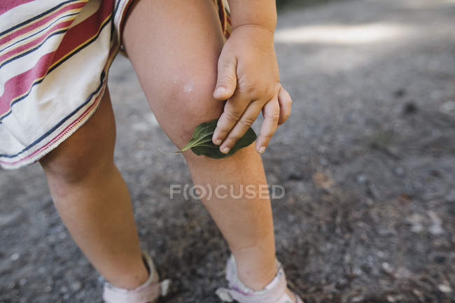 Kleines Mädchen überzieht Kratzer am Knie mit Blatt, Teilansicht — Stockfoto