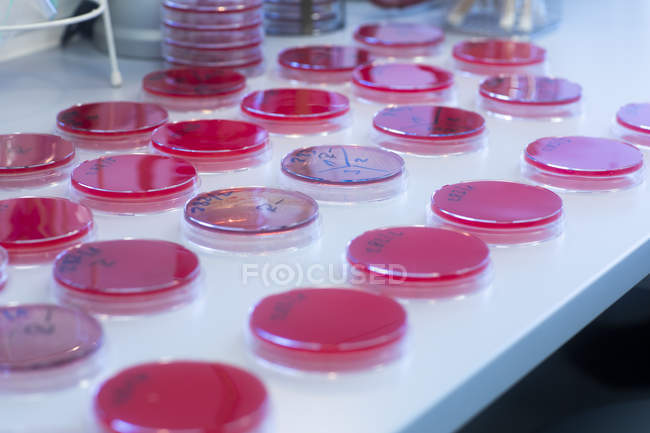Placas Petri con medio de crecimiento en laboratorio - foto de stock
