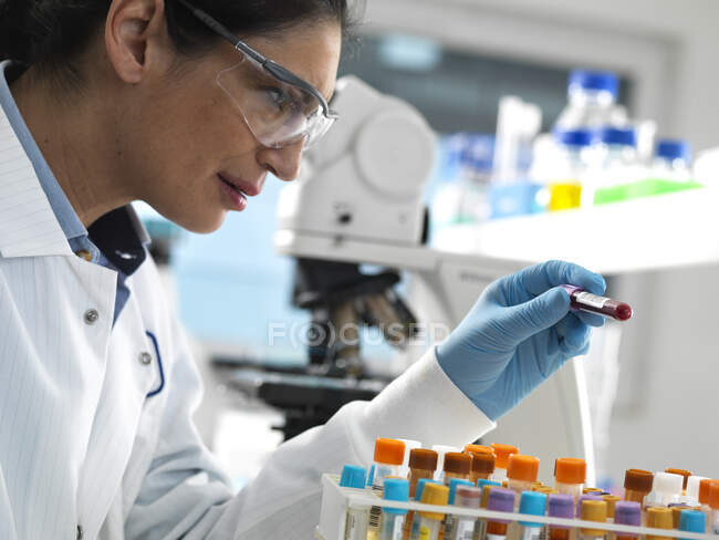Técnico de laboratorio que prepara una variedad de muestras humanas para pruebas médicas en el laboratorio - foto de stock