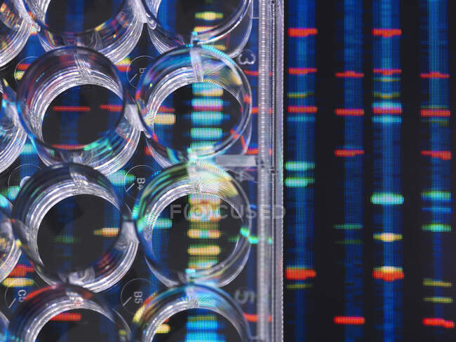 Investigación de ADN, muestras de ADN en una placa de varios pozos listo para su análisis con los resultados de ADN en el fondo - foto de stock