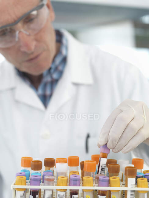 Técnico médico revisando muestras de sangre en el laboratorio - foto de stock