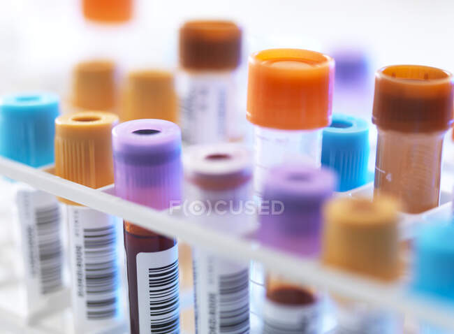 Una fila de muestras de sangre humana a la espera de pruebas en el laboratorio - foto de stock