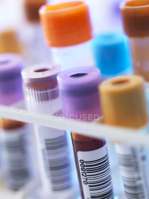 Ряд образцов человеческой крови в ожидании тестирования в лаборатории — стоковое фото