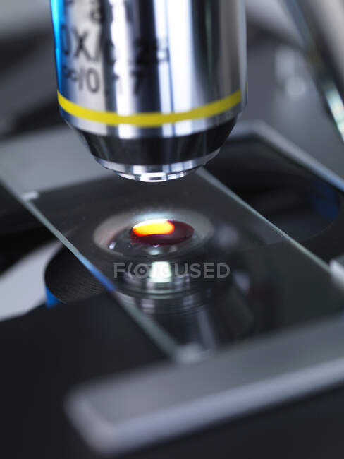 Muestra humana analizada bajo microscopio de luz en laboratorio - foto de stock