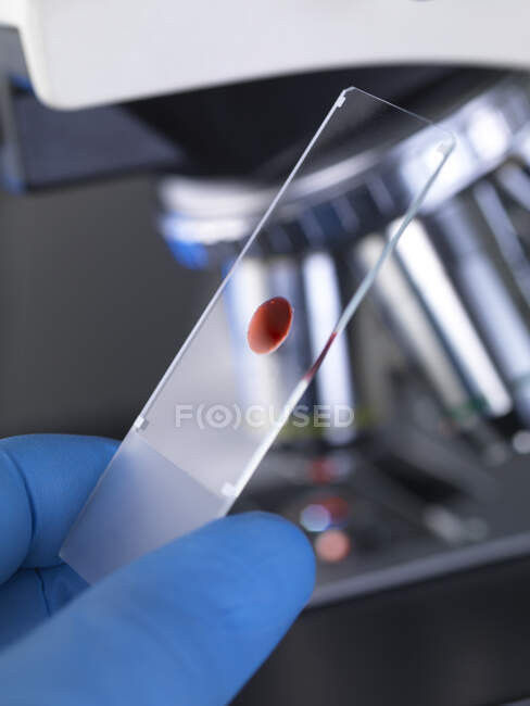 Scientist examining a glass slide containing a human sample under a microscope — Stock Photo