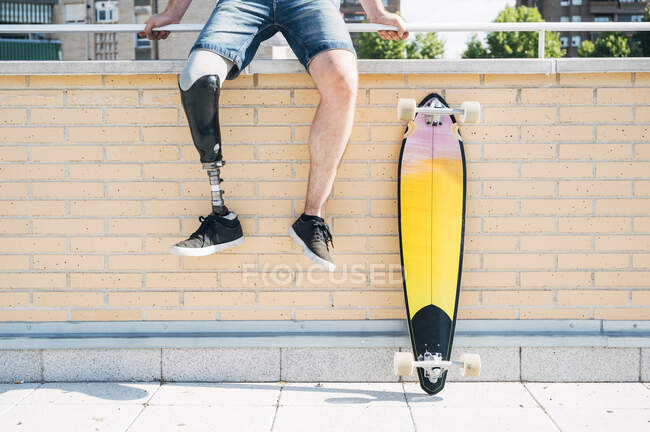 Joven con prótesis de pierna sentado en barandilla en la ciudad junto al monopatín - foto de stock
