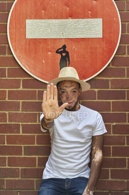 Retrato de un joven con vitiligo usando un sombrero haciendo una señal de stop con la mano en una señal prohibida - foto de stock
