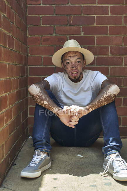 Retrato de un joven con vitiligo con sombrero - foto de stock