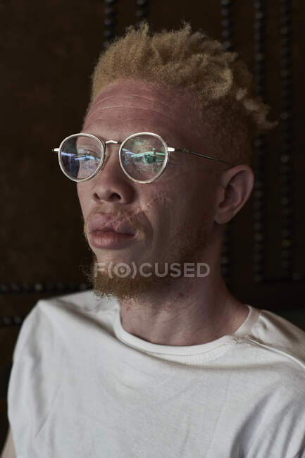 Albino-Mann mit runder Brille schaut zur Seite — Stockfoto