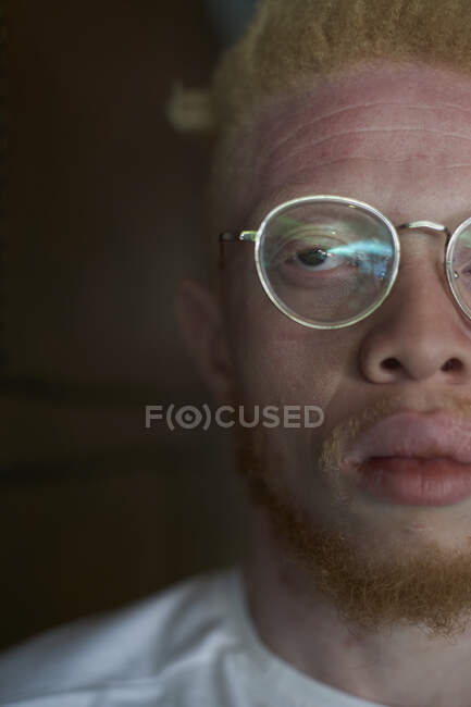 Half portrait of an albino man with round glasses — Stock Photo
